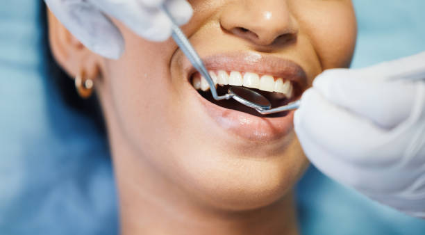 Best Emergency Tooth Extraction in Richwood, TX