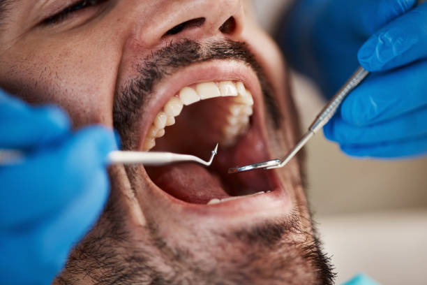Best Emergency Treatment for Toothache in Richwood, TX