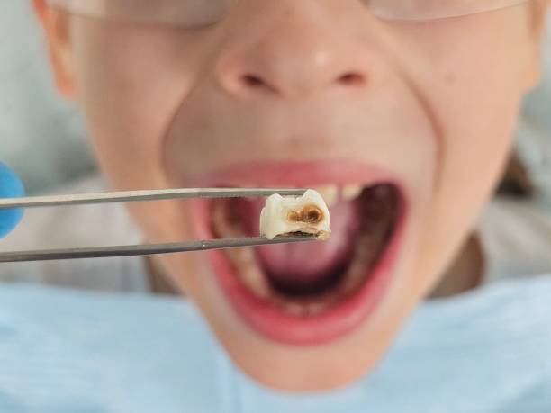 Best Emergency Dental Care for Trauma or Injury in Richwood, TX