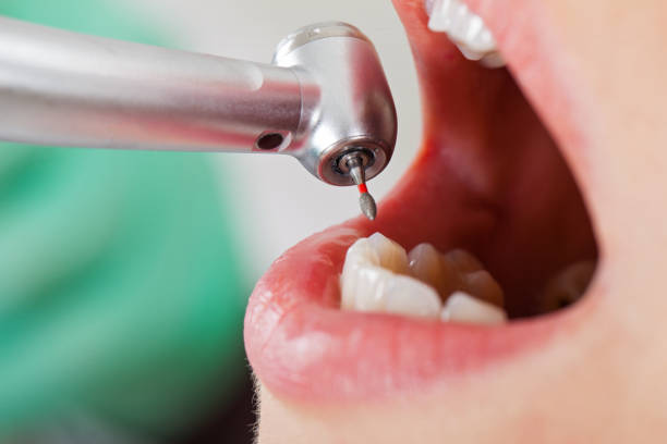 Best Emergency Treatment for Toothache in Richwood, TX